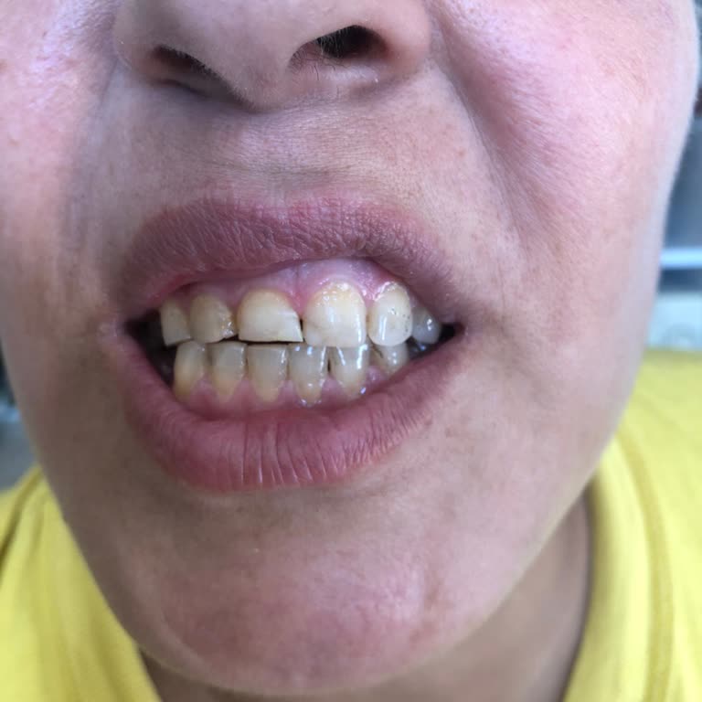 Elazığ Fethi Sekin Şehir Hastanesi Diş Hekimi Deneyimi Üzerine Değerlendirme