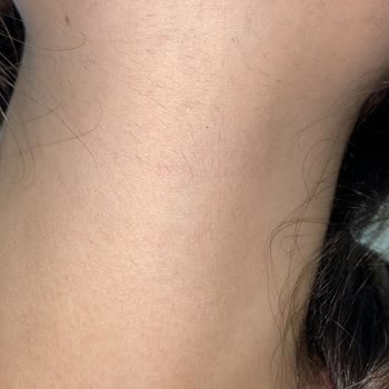 Aris Güzellik Merkezleri A*** Samsun Lazer Felaketi