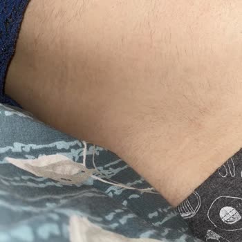 Aris Güzellik Merkezleri A*** Samsun Lazer Felaketi