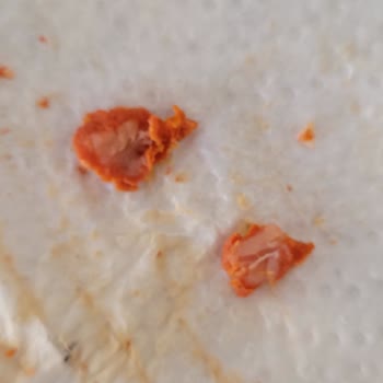 Maret Sucuk İçindeki Yabancı Parçalar