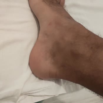 Aldo Shoes Aldığım Ayakkabı Mağdur Edildim