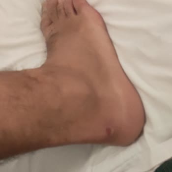 Aldo Shoes Aldığım Ayakkabı Mağdur Edildim