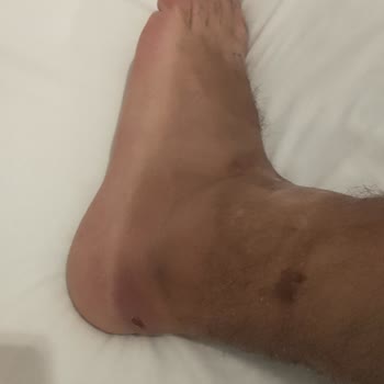 Aldo Shoes Aldığım Ayakkabı Mağdur Edildim