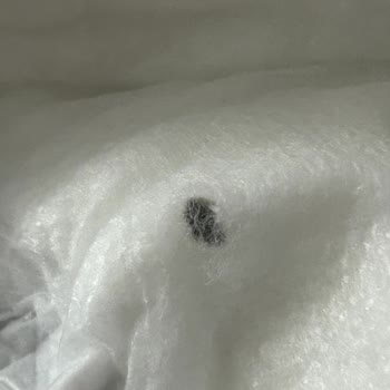 Sleepy Bebek Bezinin İçinde Sert Bir Cisim