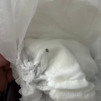 Sleepy Bebek Bezinin İçinde Sert Bir Cisim