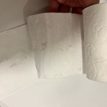 Selpak Tuvalet Kağıdı Şikayet