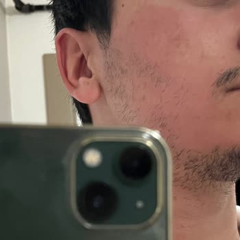 Sebamed Güneş Kremi Cildi Yakıyor