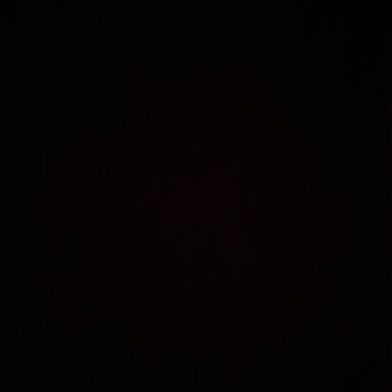 Renault Gülpar Kayseri Renault Zamanlar Servis Araca Zarar