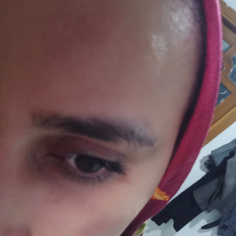 Bluemoon Estetik & Güzellik Merkezi Yaşadığım Olumsuz Deneyim