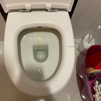 Kale Klozet Oturağı Kırıldı