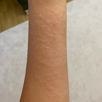 Eda Taşpınar Bronzlaştırıcı Yağ Şikayet