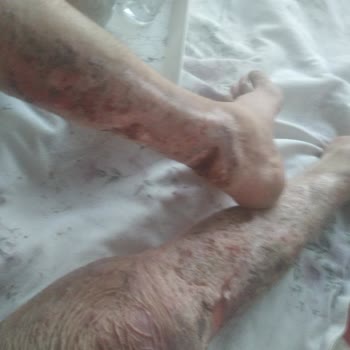 Sağlık Bakanlığı Doktorumun Beni İntihara Sürüklemesi