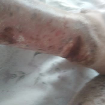 Sağlık Bakanlığı Doktorumun Beni İntihara Sürüklemesi