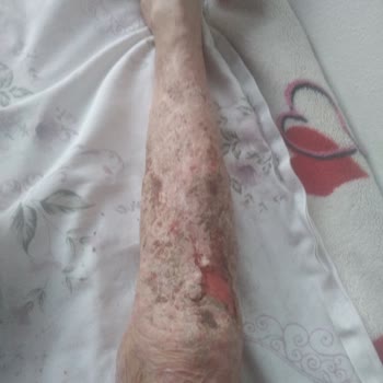 Sağlık Bakanlığı Doktorumun Beni İntihara Sürüklemesi