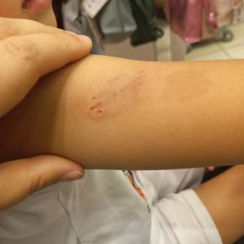 Atlantis Matmazel Mağazasında Çocuğumu Köpek Isırdı.