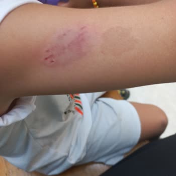 Atlantis Matmazel Mağazasında Çocuğumu Köpek Isırdı.