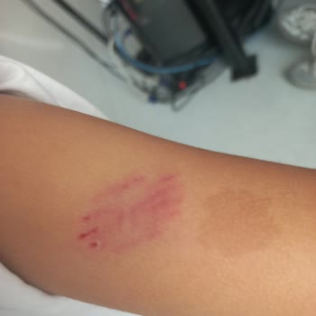 Atlantis Matmazel Mağazasında Çocuğumu Köpek Isırdı.