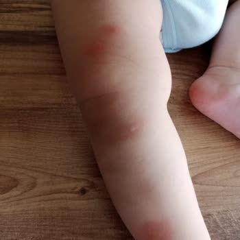 Kocaeli Büyükşehir Belediyesi Sivri Sinek İçin İlaçlama Talebi