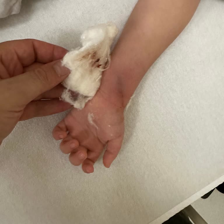 Konya Şehir Hastanesi Damar Yolu Açamayan Çocuk Hemşiresi