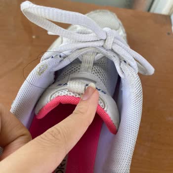 Skechers Ayakkabı 1 Yılda Yıprandı!