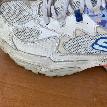 Skechers Ayakkabı 1 Yılda Yıprandı!