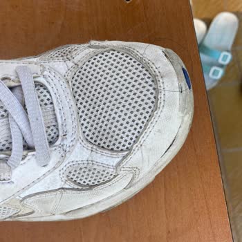 Skechers Ayakkabı 1 Yılda Yıprandı!