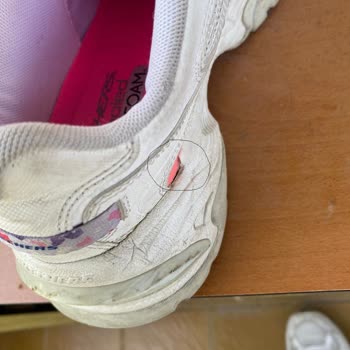 Skechers Ayakkabı 1 Yılda Yıprandı!