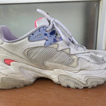 Skechers Ayakkabı 1 Yılda Yıprandı!