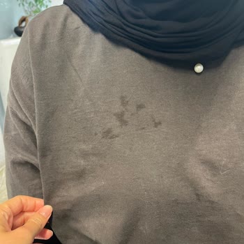 Manuka Ürün Kalitesizliği Ve Müşteri Hizmetleri Problemleri