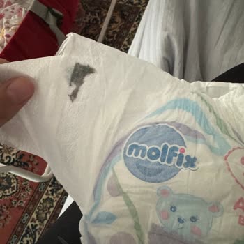 Molfix Bebek Bezi İçerisinde Yabancı Maddeler Çıktı
