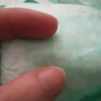 A101 Bezinde Sert Cisim Çıktı