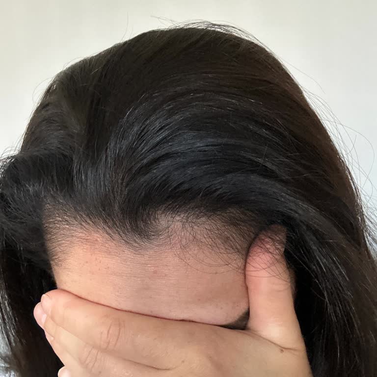 Koleston 6.0 Boya Renk Farklılığı