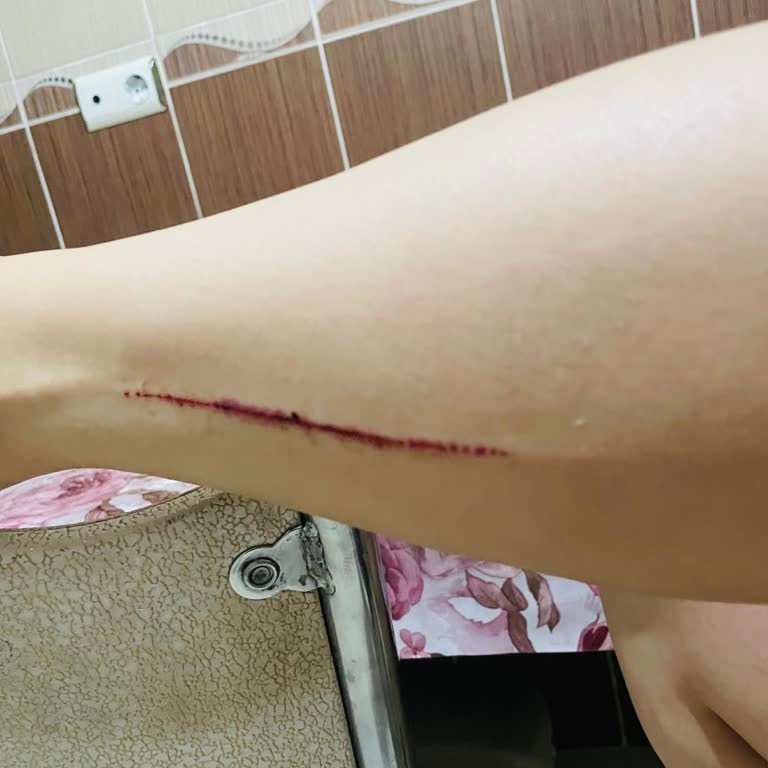 Addax Mağazasında Sorumsuzluk Yüzünden Yaralanma