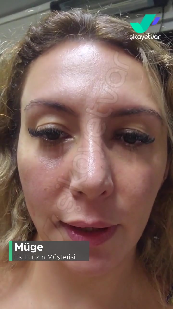 Es Turizm Bizi 1 Saat 15 Dakika Bekletiyor! videonun kapak resmi