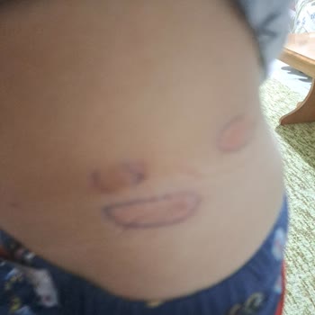 Argivit Focus Aldım Ve Köpürerek Açıldı.