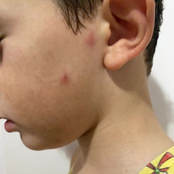 Kocasinan Belediyesi Bir Zahmet İlaçlama Yap