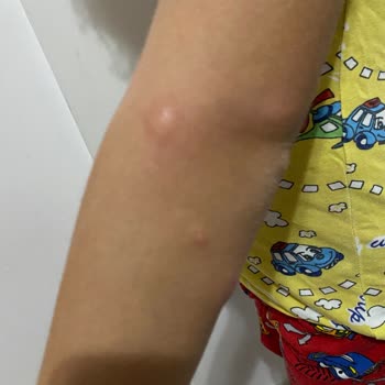 Kocasinan Belediyesi Bir Zahmet İlaçlama Yap