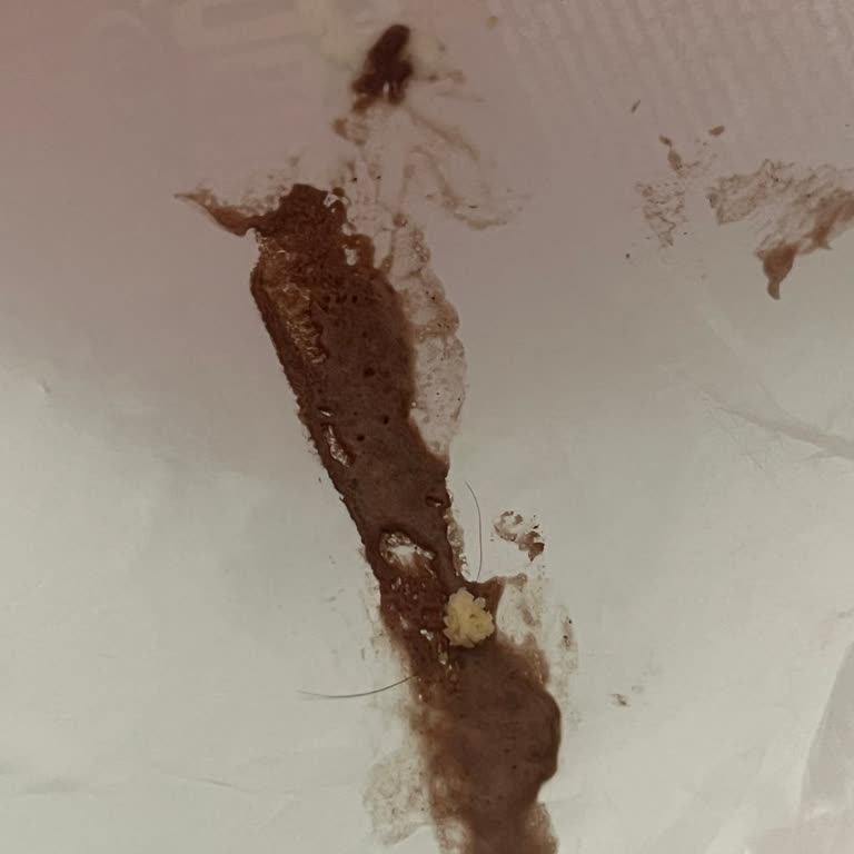 Algida Nogger İçinden Kil Çıktı