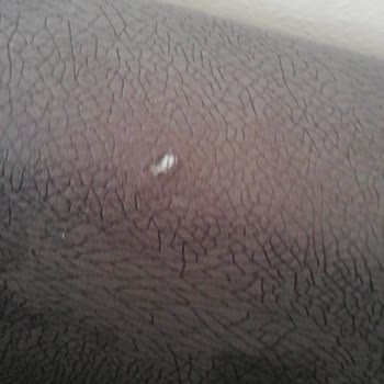 Vivense Koltuk Takımı Kumaşının Delik Olarak Gönderilmesi