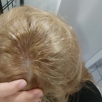 Palette Saç Diplerimi Yara Yaptı