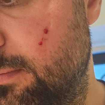 A101 De Satılan Gediz Maden Suyu Patlaması