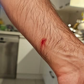 A101 De Satılan Gediz Maden Suyu Patlaması