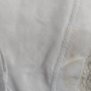 Profilo Leke Çıkarmıyor Mağdurum