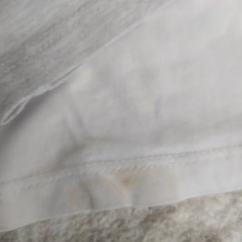 Profilo Leke Çıkarmıyor Mağdurum