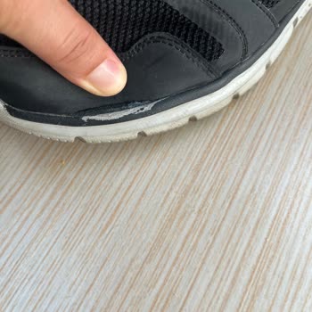 Skechers Satarken İki Yıl Garantili Deyip İlgilenmemeleri
