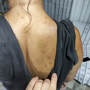 Reis Beach Hotel Reis Beach Otel Marmaris Tahta Kurusu