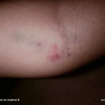 Göztepe Prof. Dr. Süleyman Yalçın Şehir Hastanesi Tecrübesiz Sağlıkçılar Oturmasın Çocuklarımız Deneme Tahtası Değil