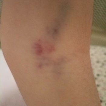 Göztepe Prof. Dr. Süleyman Yalçın Şehir Hastanesi Tecrübesiz Sağlıkçılar Oturmasın Çocuklarımız Deneme Tahtası Değil