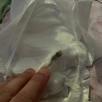 Molfix Bezin İçerisinde Siyahlık