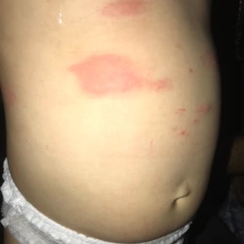 Bebelac Tarihi Geçik Bebek Maması